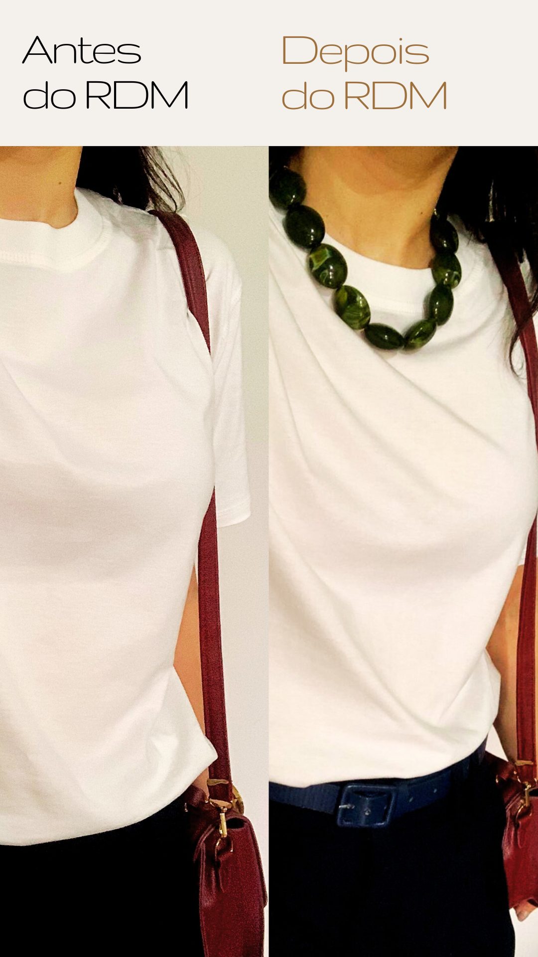 Antes e depois do RDM — aluna 1