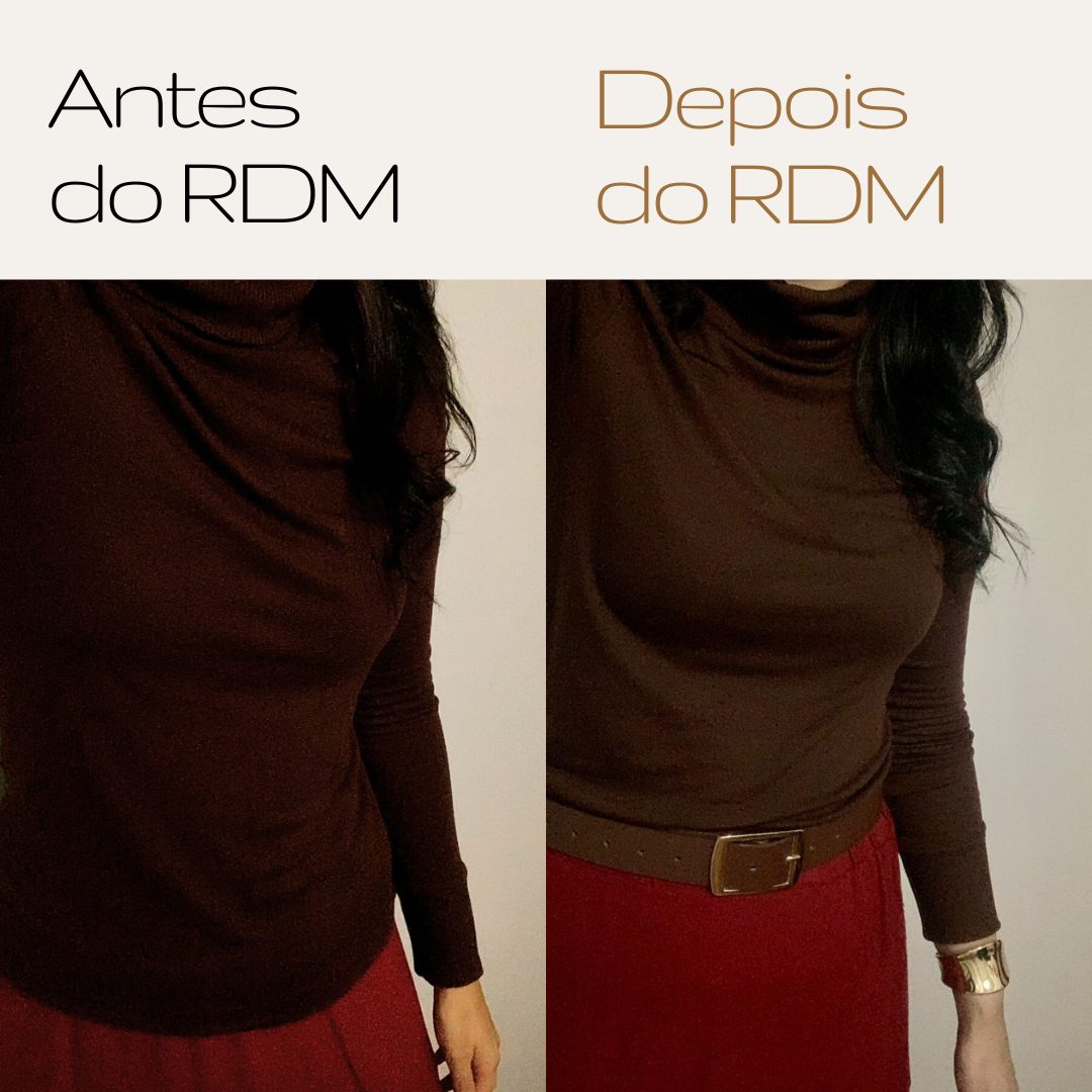 Antes e depois do RDM — aluna 7